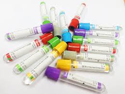 Вакуумные пробирки в наличии на складе.